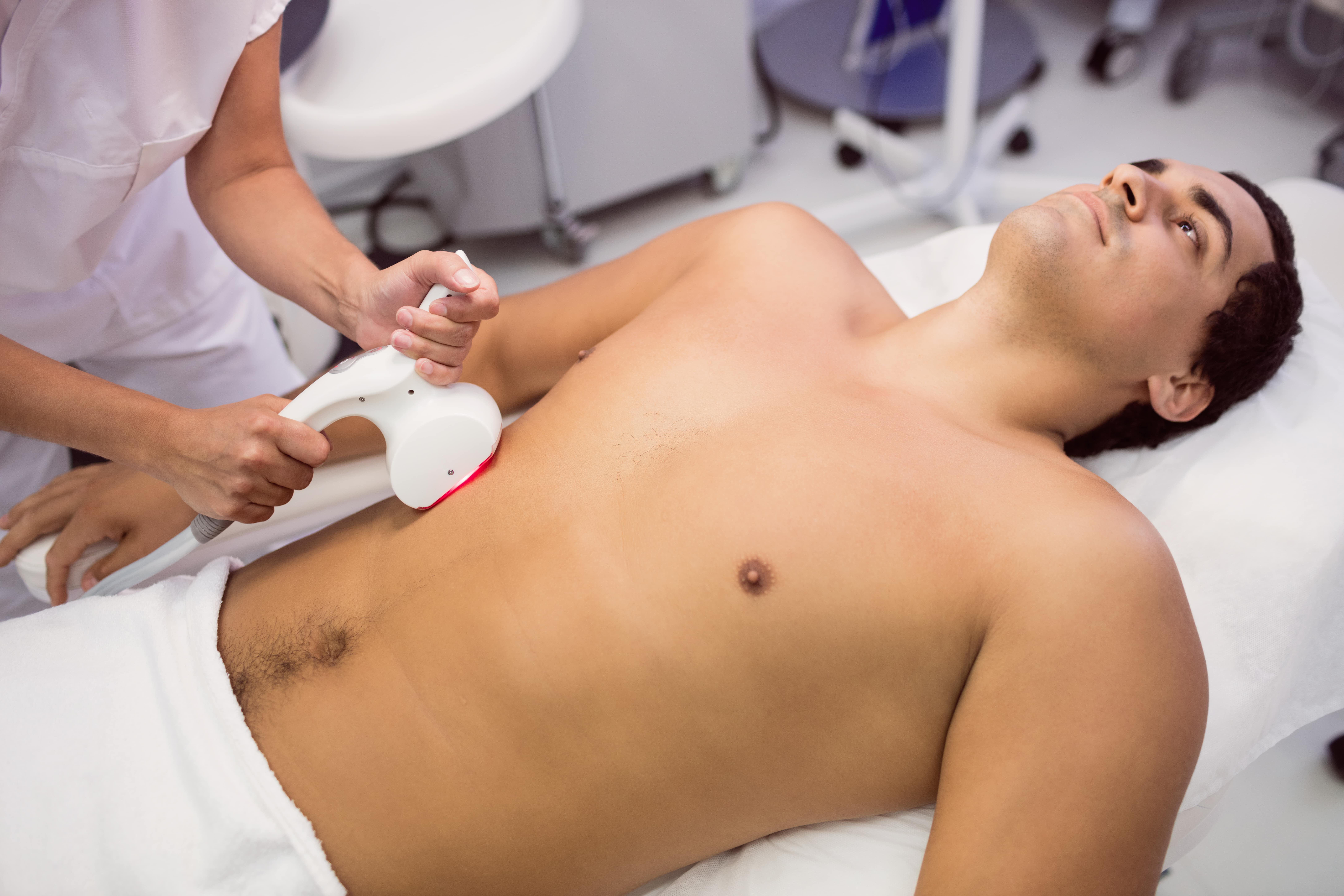 Laser hair removal treatment